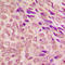 STAT3 antibody, LS-C352900, Lifespan Biosciences, Immunohistochemistry paraffin image 