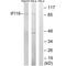 Gamma-interferon-inducible protein 16 antibody, A00848, Boster Biological Technology, Western Blot image 