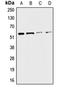 Cholinergic Receptor Nicotinic Alpha 3 Subunit antibody, orb213738, Biorbyt, Western Blot image 