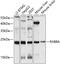 Ras-related protein Rab-8A antibody, 19-105, ProSci, Western Blot image 