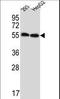 Endogenous Retrovirus Group 3 Member 1, Envelope antibody, LS-C167819, Lifespan Biosciences, Western Blot image 