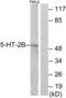 5-Hydroxytryptamine Receptor 2B antibody, LS-C119368, Lifespan Biosciences, Western Blot image 