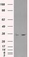 L-lactate dehydrogenase A chain antibody, GTX84226, GeneTex, Western Blot image 
