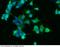 Carnosine Dipeptidase 1 antibody, 10077-R001, Sino Biological, Immunohistochemistry frozen image 