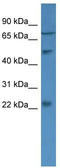 Guanylate Cyclase Activator 1B antibody, TA342731, Origene, Western Blot image 