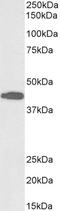 Sterol O-Acyltransferase 1 antibody, LS-C502418, Lifespan Biosciences, Western Blot image 