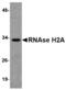 Ribonuclease H2 subunit A antibody, MBS151275, MyBioSource, Western Blot image 