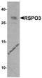 RSPO3 antibody, 8153, ProSci Inc, Western Blot image 