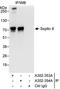 SEPT9 antibody, A302-354A, Bethyl Labs, Immunoprecipitation image 