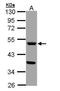 Tryptophan Hydroxylase 1 antibody, GTX109027, GeneTex, Western Blot image 