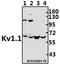 Potassium voltage-gated channel subfamily A member 1 antibody, A01813, Boster Biological Technology, Western Blot image 