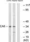 Carbonic anhydrase VI antibody, A30037, Boster Biological Technology, Western Blot image 