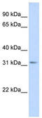 Secretagogin, EF-Hand Calcium Binding Protein antibody, TA346448, Origene, Western Blot image 