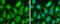 Human Papilloma virus antibody, GTX634337, GeneTex, Immunofluorescence image 