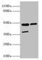 Leukocyte Immunoglobulin Like Receptor B4 antibody, LS-C675990, Lifespan Biosciences, Western Blot image 