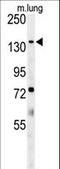 Probable phospholipid-transporting ATPase 11C antibody, LS-C156636, Lifespan Biosciences, Western Blot image 