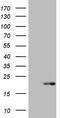 S100 Calcium Binding Protein A9 antibody, CF804481, Origene, Western Blot image 