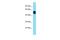 Receptor Transporter Protein 3 antibody, PA5-70842, Invitrogen Antibodies, Western Blot image 