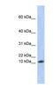 Ribosomal Protein L30 antibody, NBP1-52873, Novus Biologicals, Western Blot image 