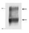 NPC Intracellular Cholesterol Transporter 1 antibody, TA336646, Origene, Western Blot image 