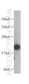 Actin Related Protein 2/3 Complex Subunit 3 antibody, 14652-1-AP, Proteintech Group, Western Blot image 