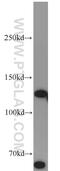 RNA Binding Motif Protein 6 antibody, 14360-1-AP, Proteintech Group, Western Blot image 