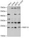 RAB11A, Member RAS Oncogene Family antibody, 14-092, ProSci, Western Blot image 