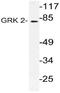 G Protein-Coupled Receptor Kinase 2 antibody, AP21131PU-N, Origene, Western Blot image 