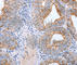Claudin 3 antibody, A2946, ABclonal Technology, Immunohistochemistry paraffin image 