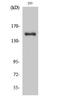 Collagen Type IV Alpha 3 Chain antibody, A01755, Boster Biological Technology, Western Blot image 