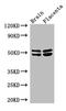 B1AR antibody, LS-C498290, Lifespan Biosciences, Western Blot image 
