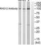 Rho GTPase Activating Protein 12 antibody, TA316001, Origene, Western Blot image 