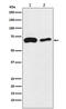 Long-chain fatty acid transport protein 4 antibody, M05299, Boster Biological Technology, Western Blot image 