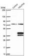 NADH:Ubiquinone Oxidoreductase Subunit A9 antibody, NBP2-13646, Novus Biologicals, Western Blot image 