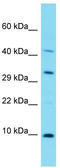 NADH:Ubiquinone Oxidoreductase Complex Assembly Factor 8 antibody, TA334846, Origene, Western Blot image 