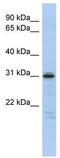 Homeobox D9 antibody, TA335631, Origene, Western Blot image 