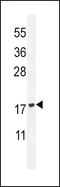Phospholipase A2 Group IID antibody, MBS6002811, MyBioSource, Western Blot image 