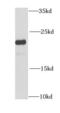Calcium And Integrin Binding 1 antibody, FNab01708, FineTest, Western Blot image 