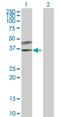 SplA/Ryanodine Receptor Domain And SOCS Box Containing 3 antibody, H00090864-B01P, Novus Biologicals, Western Blot image 
