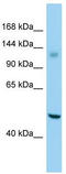 G Protein-Coupled Receptor 158 antibody, TA331816, Origene, Western Blot image 