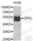 Probable serine carboxypeptidase CPVL antibody, A4783, ABclonal Technology, Western Blot image 