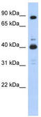 Cyclin Dependent Kinase 9 antibody, TA330348, Origene, Western Blot image 