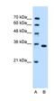 Thymidylate Synthetase antibody, orb325401, Biorbyt, Western Blot image 