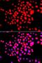Serine/threonine-protein kinase 19 antibody, LS-C748435, Lifespan Biosciences, Immunofluorescence image 