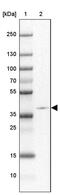 Zinc Finger Protein 365 antibody, PA5-62611, Invitrogen Antibodies, Western Blot image 