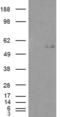 Glucosaminyl (N-Acetyl) Transferase 3, Mucin Type antibody, NB100-93400, Novus Biologicals, Western Blot image 