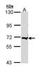 Complement C9 antibody, LS-B4849, Lifespan Biosciences, Western Blot image 