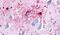Golgi pH regulator antibody, PA5-33786, Invitrogen Antibodies, Immunohistochemistry paraffin image 