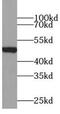 Zinc Finger RANBP2-Type Containing 2 antibody, FNab09755, FineTest, Western Blot image 