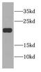 Cysteine And Glycine Rich Protein 2 antibody, FNab02030, FineTest, Western Blot image 